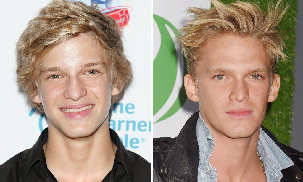 cody-simpson-before-and-after